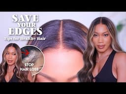 SAVE YOUR EDGES! STOP DOING THIS WITH YOUR LACE WIGS! Tips for HEALTHY HAIR 😍