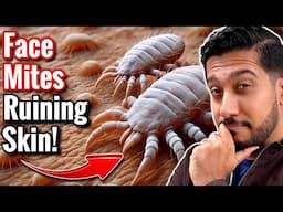 How to Get Rid of Face Mites Fast | Easy Face Mites Removal