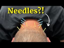 Article Review: Dry Needling for Neck Pain in Combat Athletes