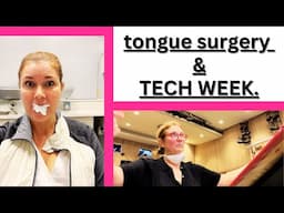 tongue surgery and tech week...& maybe trash to treasure? My adventures over the last 3 weeks!