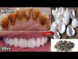 Japanese secret! Can you whiten teeth at home in 2 minutes?Secret that Dentists don't want you to kn