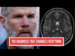 Brett Favre's Parkinson's: Hidden Danger in Football?