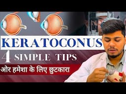 Get Rid Of KERATOCONUS Permanently | Keratoconus | keratoconus Treatment without surgery