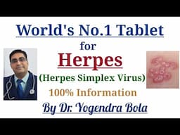 Herpes infection ( HSV 1 & 2 )...Complete treatment. ....by  Dr Yogendra Bola