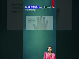 Nails color से जानिए आपकी हेल्थ के बारे में ...#medical