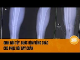 Đinh nội tủy: Phương pháp tốt nhất - bước đệm vững chắc giúp phục hồi gãy chân | Toàn cảnh 24h