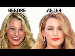 Blake Lively's Plastic Surgery Procedures: The Face She Deserves? (2024)