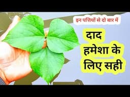 दाद दो बार में सही हो जाएगा | Desi Dava For Daad | Herbs Plant || Home Garden