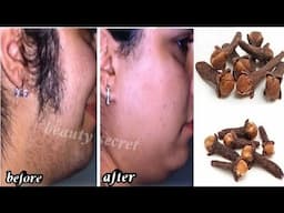 Cloves are stronger than laser! Permanently eliminates unwanted hair 5 minutes.