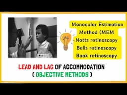 Lead and Lag Made Simple: MEM, Notts, Bell, and Book Retinoscopy Explained