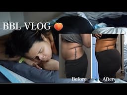 I GOT A BBL 🍑 Raw & Uncut first 3 days after a bbl & lipo 360 | BBL VLOG