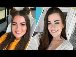 My Smile Transformation! Veneers Experience | Cloe Feldman