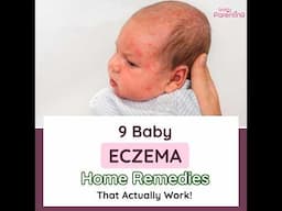 9 Effective Baby Eczema Home Remedies | Remedies for Baby Eczema | Remedies For Eczema In Babies