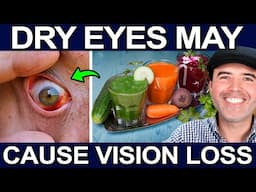 How To Get Rid Of Dry Eyes - 5 Advanced Home Natural Treatments