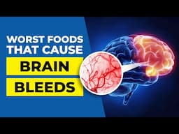 6 Worst Foods that Cause Brain Bleeds