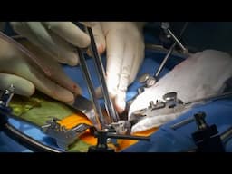 Lumbar artificial disc replacement