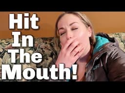 I WAS HIT IN THE MOUTH!