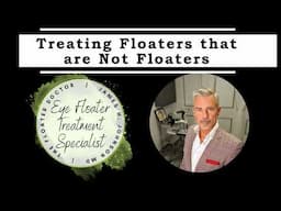 Treating Floaters Not Usually Considered Floaters