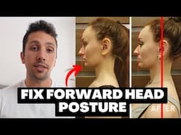 The Secret to Fixing Forward Head Posture (What They DON'T Tell You)