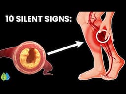 Doctors Warn: 10 Silent Signs Your Leg Arteries Are Clogged