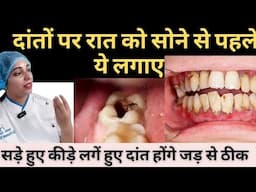 कीड़े लगे हुए ,सड़े हुए दाँत का घरेलु इलाज | Home Remedies For Decayed Tooth |