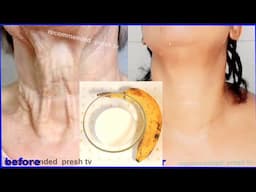 She never looks old because she remove neck wrinkles forever with milk / Neck lines home remedies