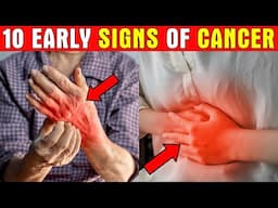 10 Cancer Signs that 90% of People Ignore| Healthy Care