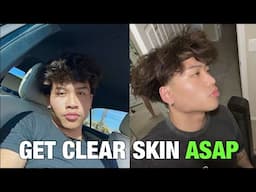 How to Get Clear Skin ASAP