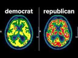 I Scanned A Democrat & Republican's Brains