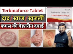 दाद, खाज, खुजली | Terbinaforce Tablet | Fungal Infection | Fungal Treatment | Medicine | Treatment