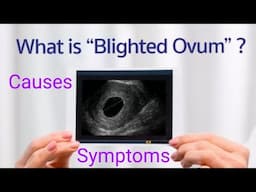 Blighted Ovum Pregnancy(Anembryonic Pregnancy):Causes & Symptoms in Hindi.@dranshumantripathi3599