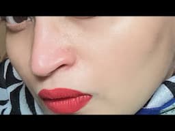 Is Boroline Antiseptic Cream good for Oily Skin ? Does it cause pimples ? Does it lighten MARKS ?