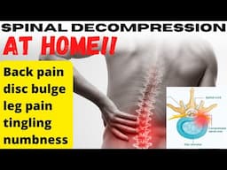 Back Pain Relief with At-Home Spinal Traction - Learn From a Chiropractor