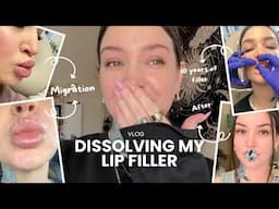 Dissolving my lip filler Vlog 👄 Self Love Vs Enhancement