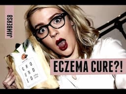 MIRACLE ECZEMA CURE! #GETGROUNDED  | Jambers8