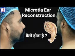 Microtia Ear Reconstruction Surgery In India Delhi Mumbai Bangalore Kolkata Hyderabad Chandigarh Goa