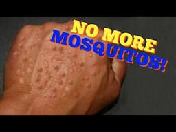 Mosquito Repellent | Home Remedy and Prevention Tips for Mosquito Bites!