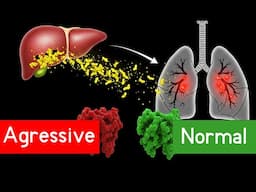 Alpha-1 Antitrypsin Deficiency - Signs, Causes, Treatment and Prognosis