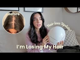 HAIR LOSS 1 YEAR UPDATE 🥲 minoxidil, iRestore, micro-needling, controversial opinion on PRP