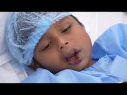 Rare Hemangioma Surgery on a Child’s Face