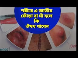 শরীরে ফোঁড়া হলে কি করনীয়?  fora hole koronio ki?