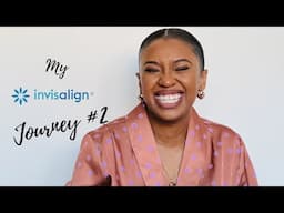 My Invisalign Journey Part 2| Keeping The Gap Tooth