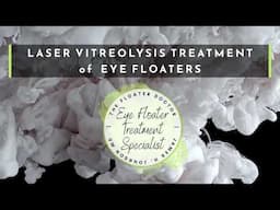 Laser Vitreolysis Treatment of Eye Floater - Doctor's View and Live  Commentary