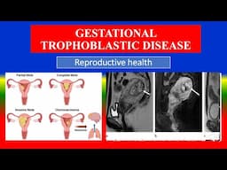 GESTATIONAL TROPHOBLASTIC DISEASE - Definition, types, causes,  symptoms , diagnoses , medicine