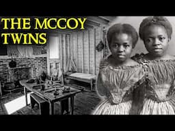 The Shocking Case of the Conjoined McCoy Twins