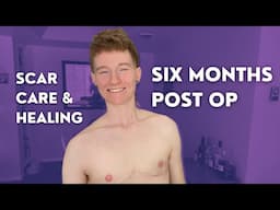 6 MONTHS POST OP | Top Surgery Recovery and Scar Care