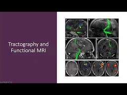 Neurosurgery and Technology - 7/17/2024