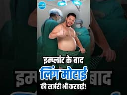 Penile Implant के 1 साल बाद Fat Grafting से Girth Enhancement | Fat Grafting से लिंग की मोटाई बढ़ाएं