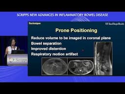 The Role of Imaging in IBD | Scripps Conference: New Advances in IBD 2023 Session