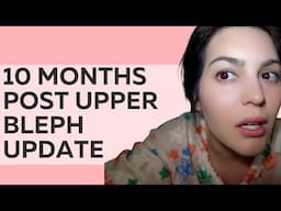 10 Months Post Upper Bleph Update & Answering your Questions